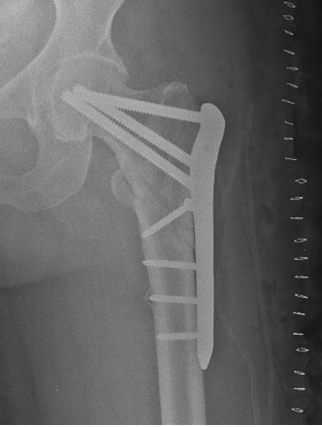 Patti Morrow's Xray